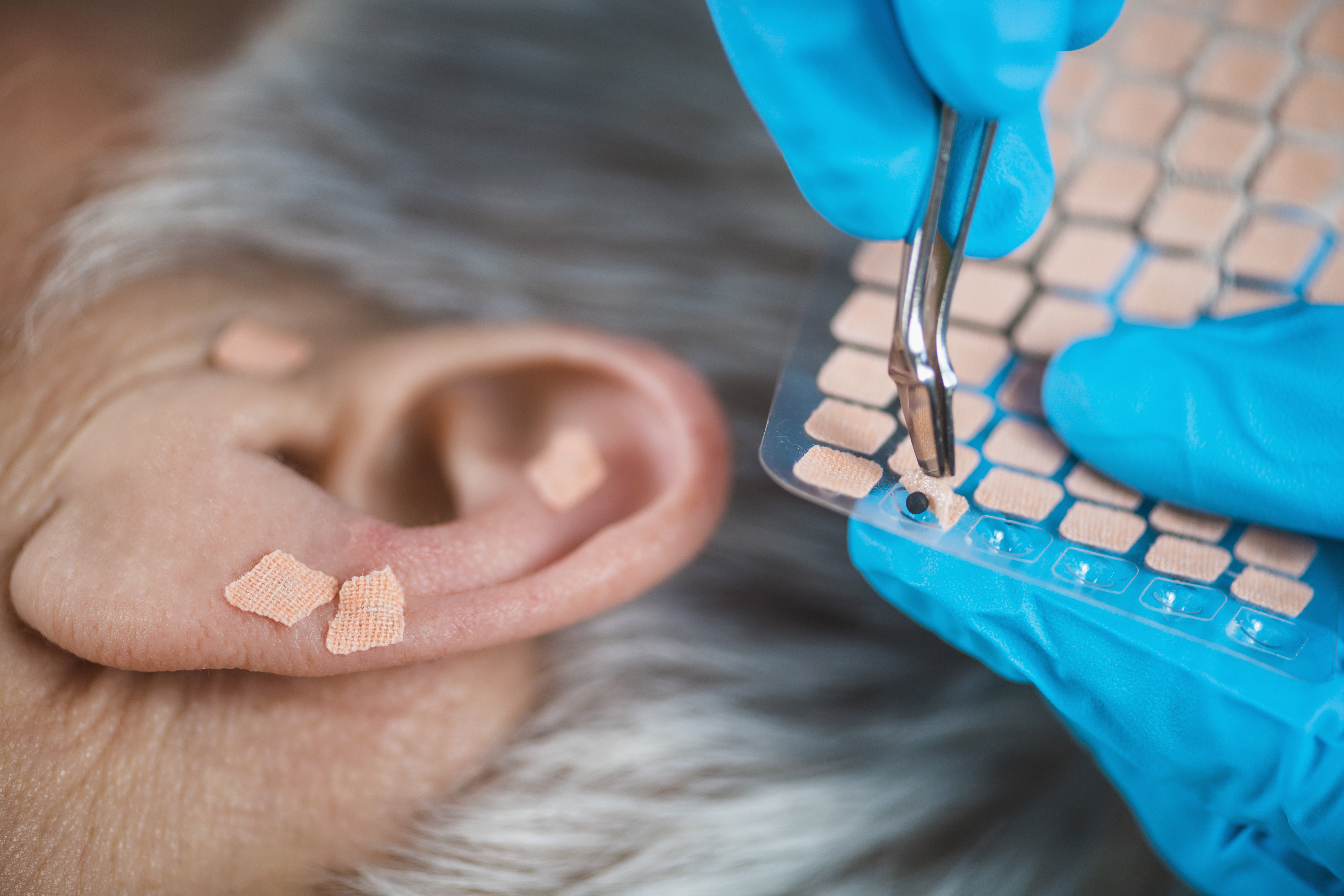Ear Acupuncture Point Therapy