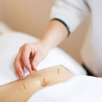Acupuncture Treatments
