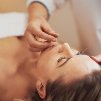 Cosmetic Acupuncture